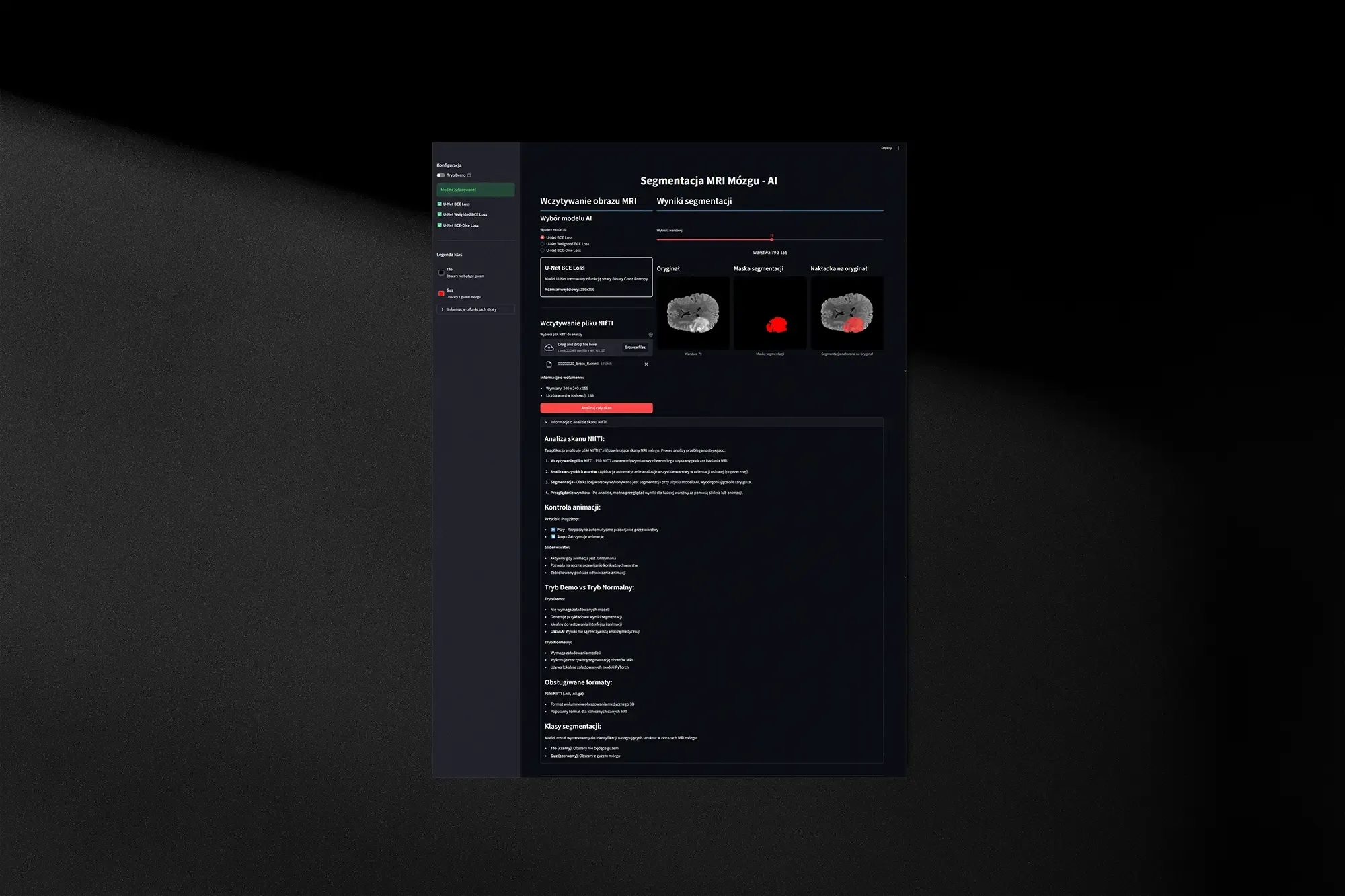 AI MRI brain segmentation