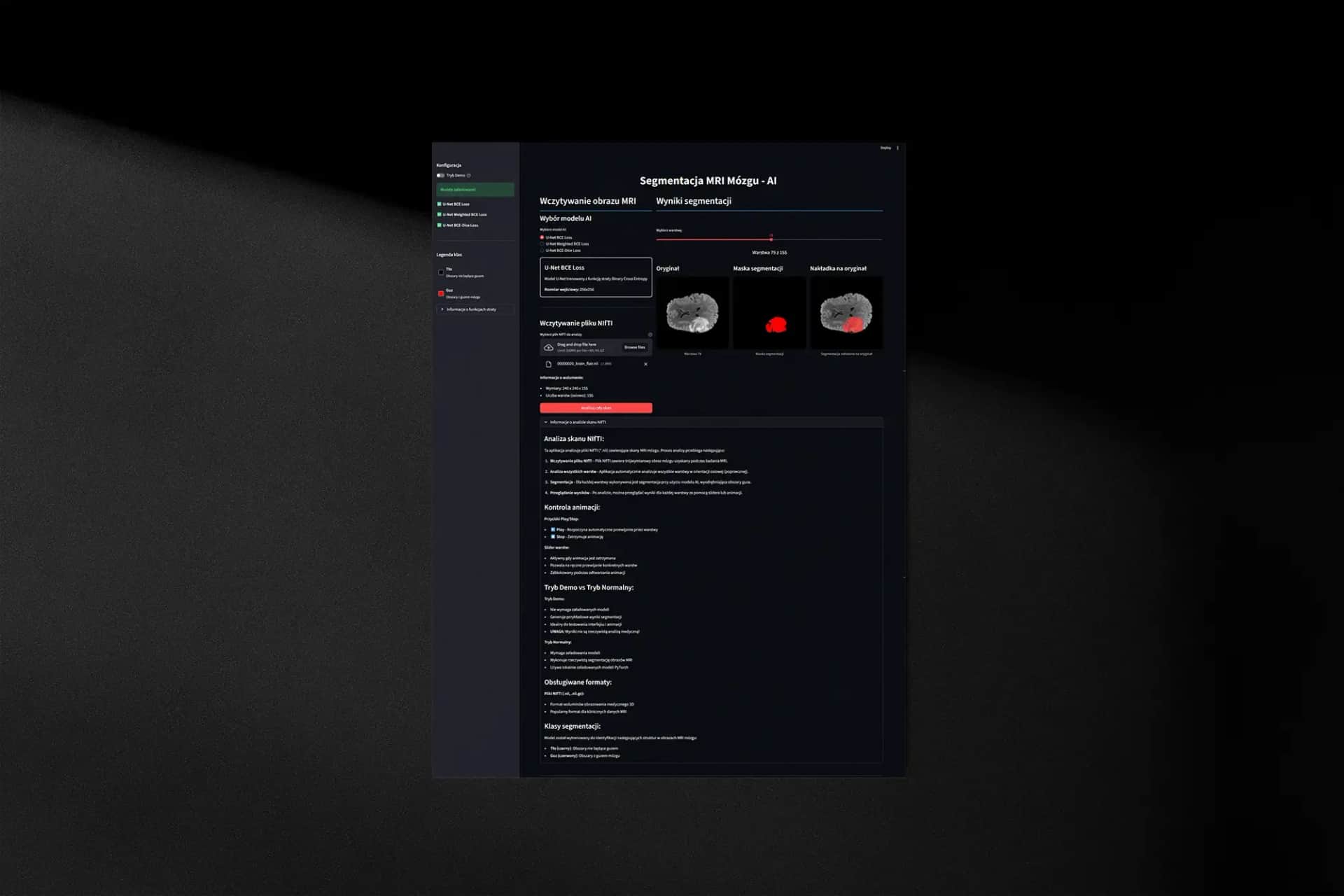 AI MRI brain segmentation