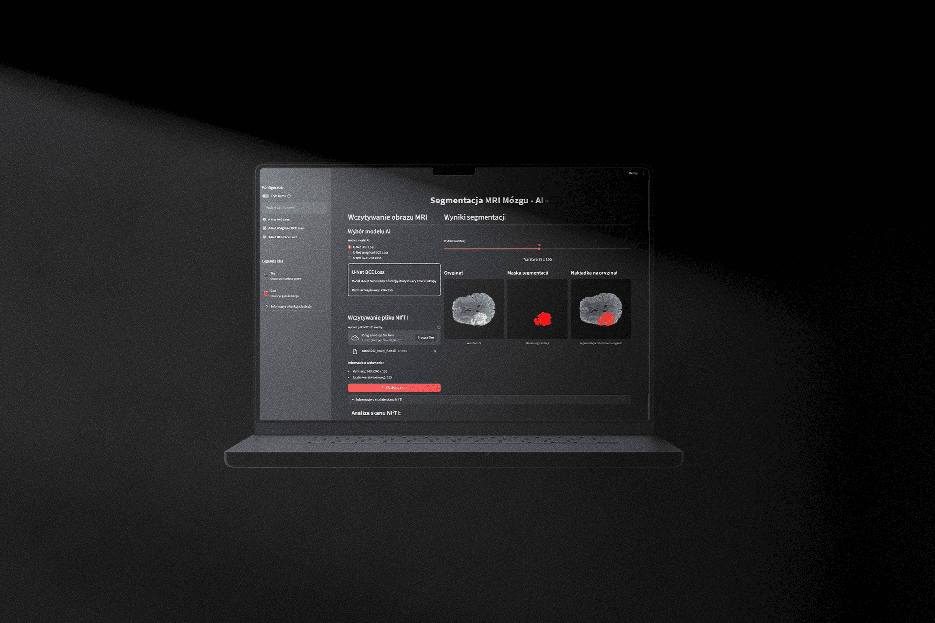 AI MRI brain segmentation