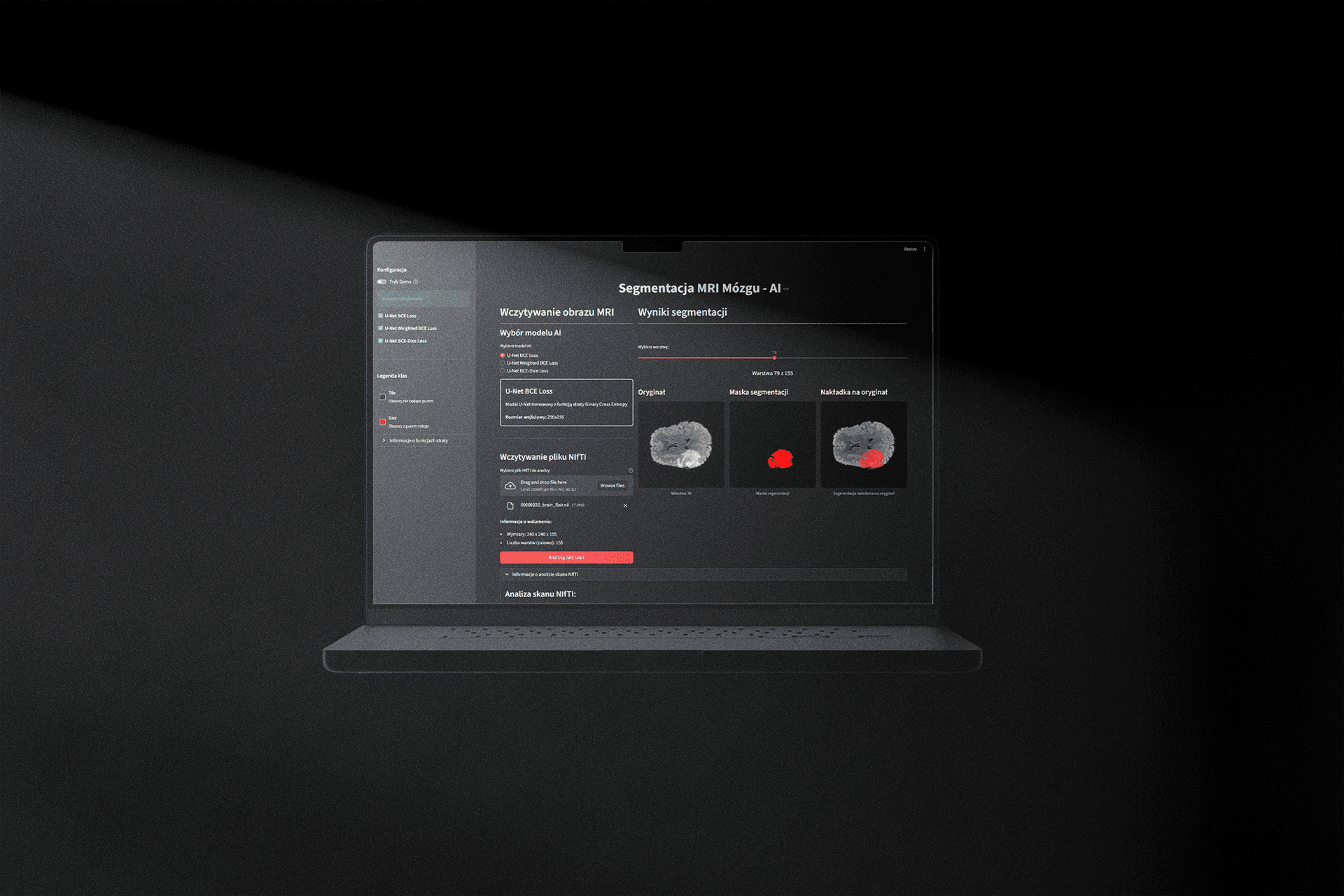 AI MRI brain segmentation